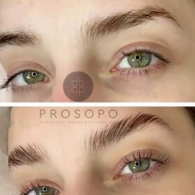 Brow Lamination στο Χαλάνδρι