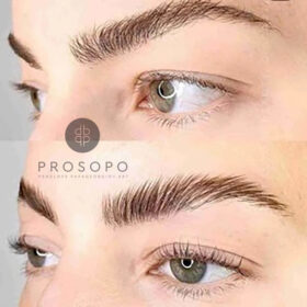 Brow Lamination στο Χαλάνδρι