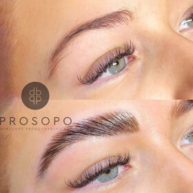 Brow Lamination στο Χαλάνδρι