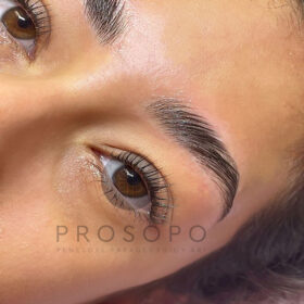 brow-lamin-3