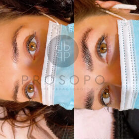Brow Lamination στο Χαλάνδρι