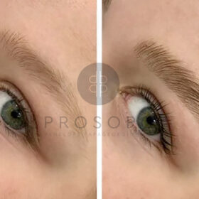 Brow Lamination στο Χαλάνδρι