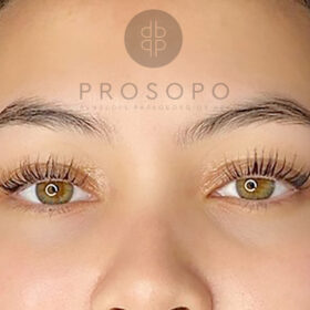 lash-lift-2