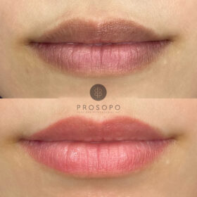 lips-3