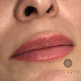 lips-4