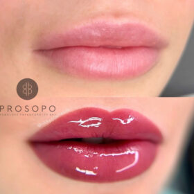 lips-5