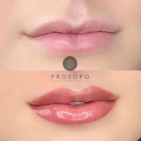 lips-6