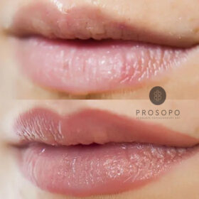 lips-7