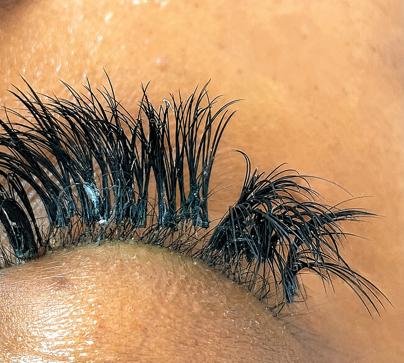 Κακή εφαρμογή eyelash extensions με υπερβολική κόλλα και πολλές φυσικές βλεφαρίδες κολλημένες μεταξύ τους.