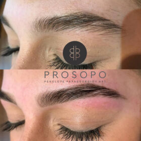 σχημα και βαφη πριν και μετα χαλανδρι