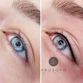 imonimo-eyeliner-xalandri-prin-meta.jpg