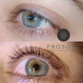 lash-lift-before-after-natural-enhancement-result-prosopo-chalandri-athens.jpg