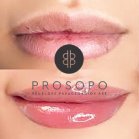lip-tattoo-prin-meta-xalandri.jpg