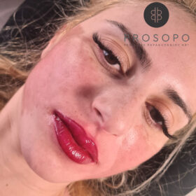pmu-lip-blush-fresh-result-xalandri-prosopo.jpg