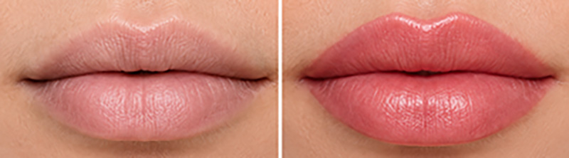 Lip Blush πριν και μετα με φυσική ενίσχυση χρώματος και περιγράμματος χειλιών στο Χαλάνδρι